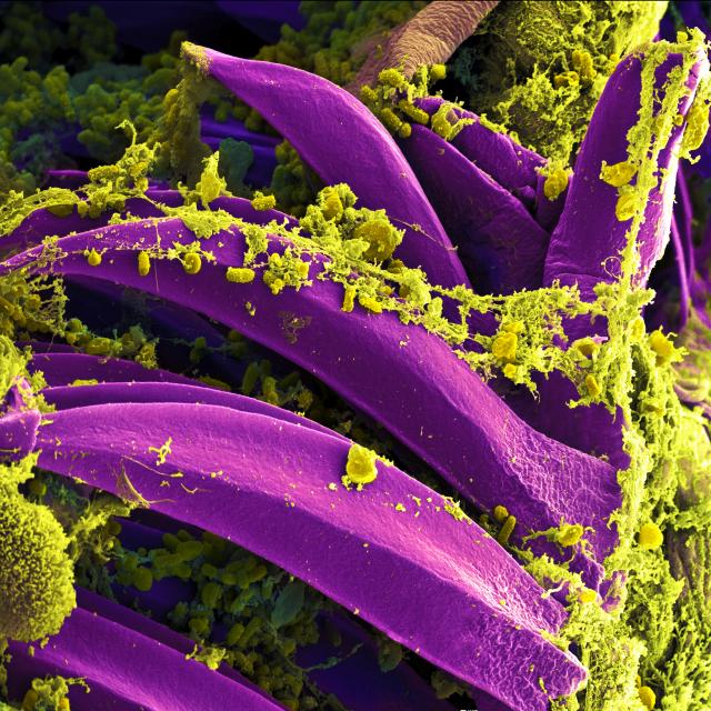 Yersinia pestis bacteria under a microscope